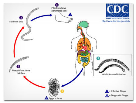 CDC Flariform ara penetrates skin Eilarifoom larva httncllwwo dnd ede gouldpdx 2 Rhabdeiform larva hatches Aduets in small intestine iroetre Stage Dia